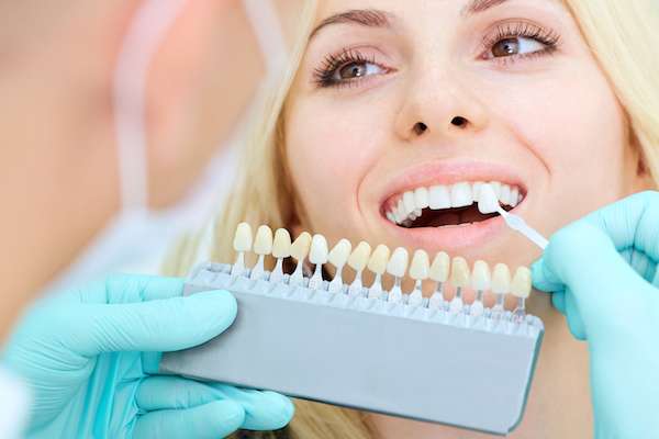 How a Cosmetic Dentist Places Dental Veneers from Wright Dental Co. Dental Office of Dr. Houston Wright in Santa Barbara, CA
